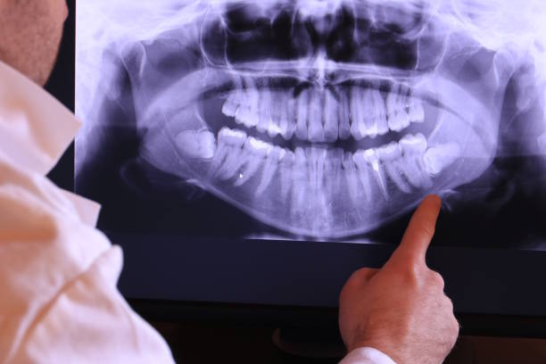 Best 24-Hour Emergency Dentist in Mason, TX
